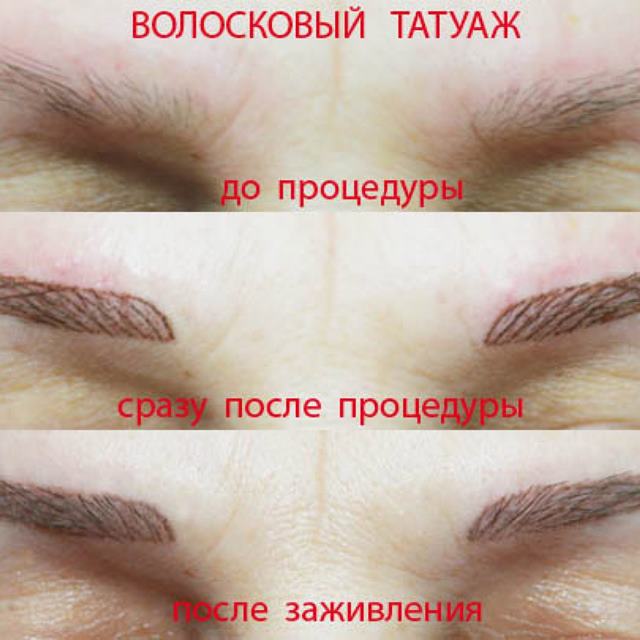 Плюсы волосковой техники