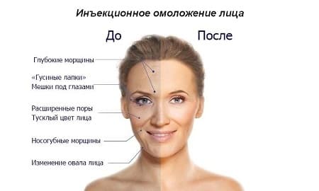 Омоложение