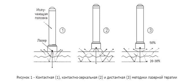 При чрескожных процедурах излучение может по-разному влиять на покровы