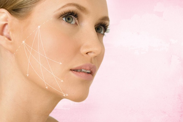 Преимущества лифтинга с нитями Aptos Visage