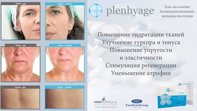 Plenhyage (Италия) Plenhyage (Италия)