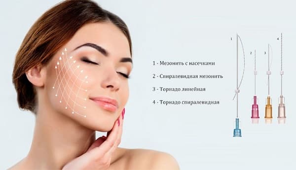 Материалы для тредлифтинга мезонитями