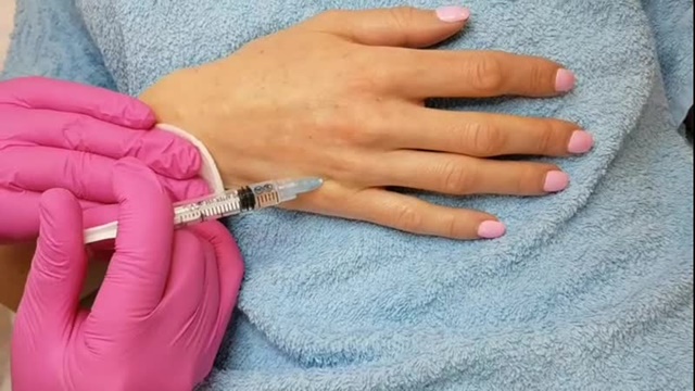 Этапы проведения процедуры